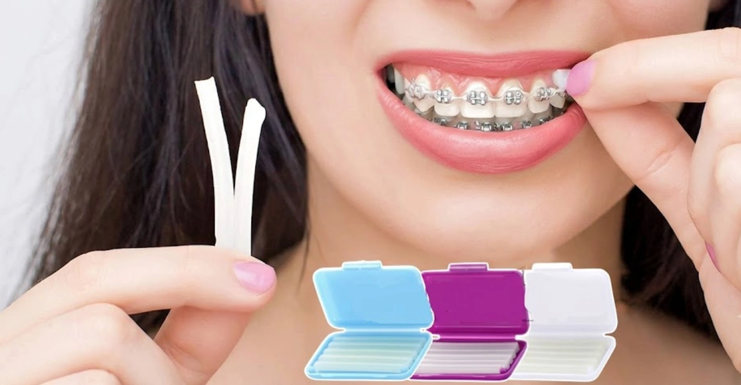2can i eat with orthodontic wax